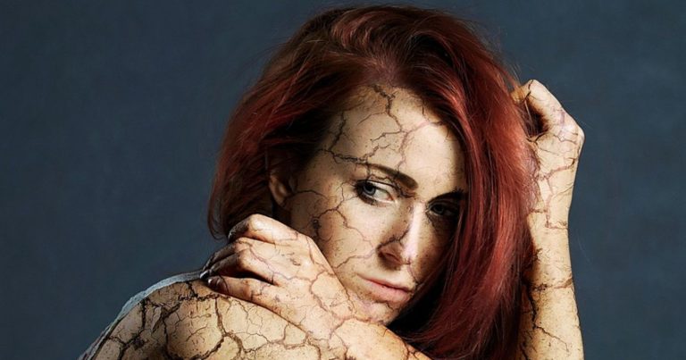 Fibromialgia, il Dottor Giuseppe Scavo spiega i sintomi e le possibili cause Fibromialgia, il Dottor Giuseppe Scavo spiega i sintomi e le possibili cause