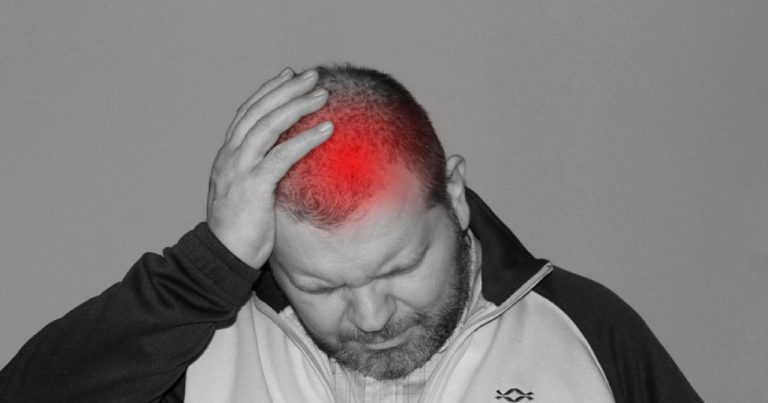 Misteriosi cambiamenti sono stati individuati nel cervello delle persone che soffrono di emicrania