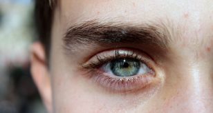 occhio ischemia oculare