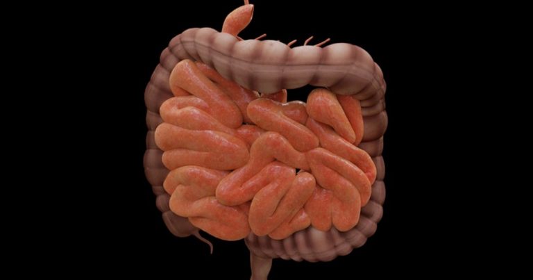 Intestino, ecco come “resettarlo” quando si accumulano troppe scorie