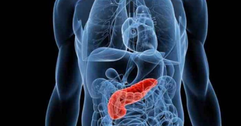 Tumore del pancreas, attenzione a questo strano sintomo: ecco quale