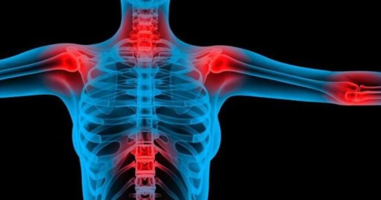 Fibromialgia, ecco quali sono i sintomi cui prestare attenzione Fibromialgia, ecco quali sono i sintomi cui prestare attenzione