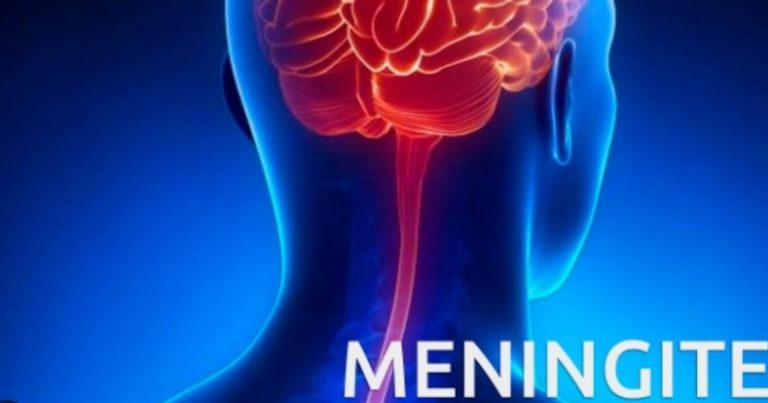 Valeria morta per meningite batterica: attenzione a questi sintomi con i quali può presentarsi