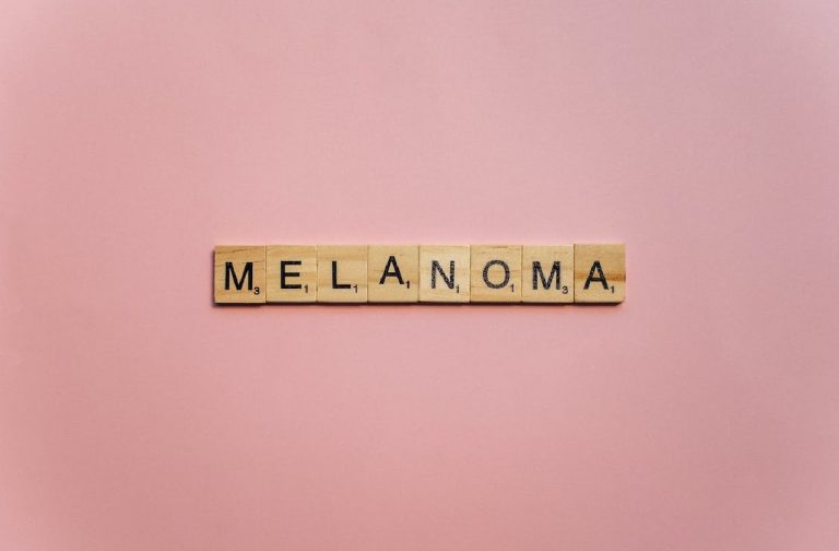 Melanoma al terzo stadio a 20 anni, il racconto di Teisha: “Ecco come l’ho scoperto…” Melanoma al terzo stadio a 20 anni, il racconto di Teisha: “Ecco come l’ho scoperto…”