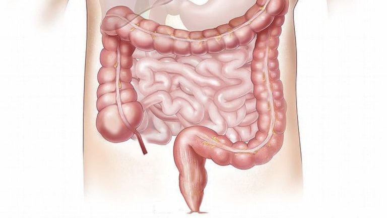 Tumore colon-retto, il professor Silvio Danese svela i tre sintomi iniziali: ecco tutti i dettagli