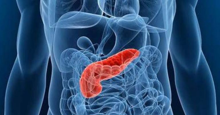 Pancreatite acuta: ecco qual è il sintomo che si manifesta più frequentemente