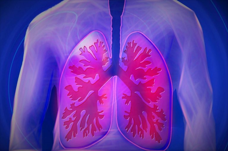 Tumore del polmone, attenzione a questo sintomo che peggiora nel tempo: ecco qual è Tumore del polmone, attenzione a questo sintomo che peggiora nel tempo: ecco qual è