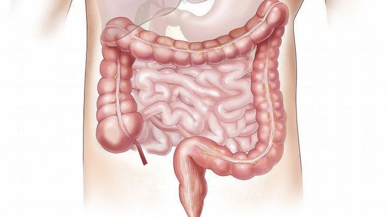 Basta un cucchiaino di questo ingrediente segreto per migliorare la salute dell’intestino: ecco qual è