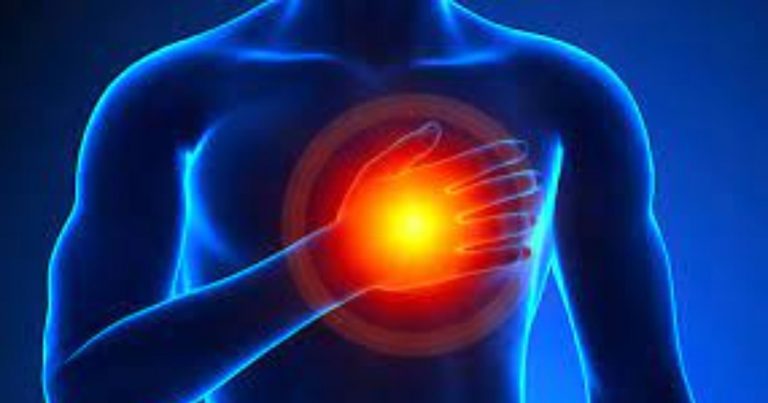 Dolore al petto: è un attacco di cuore o reflusso? Ecco come distinguerlo