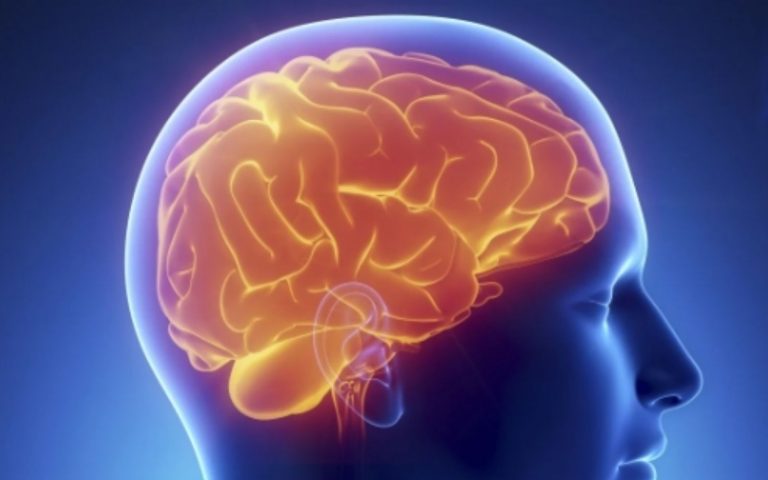 Tumore al cervello, la malattia di Lucia Zagaria: attenzione al primo sintomo tipico. Tutti i dettagli