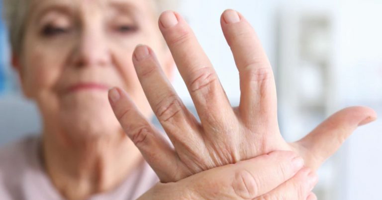 Artrite reumatoide, ecco quali sono i 7 sintomi da non sottovalutare
