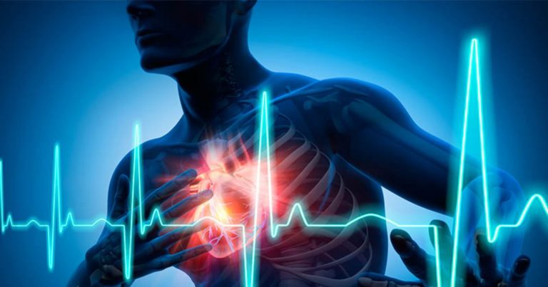 Caldo intenso, aumenta il rischio di infarto. Il cardiologo avverte: ‘Questo sintomo..’