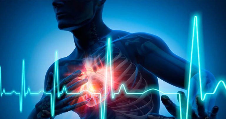 Infarto, il Dottor Furio Colivicchi svela i sintomi premonitori: “Il dolore tende a…”. Ecco tutti i dettagli Infarto, il Dottor Furio Colivicchi svela i sintomi premonitori: “Il dolore tende a…”. Ecco tutti i dettagli