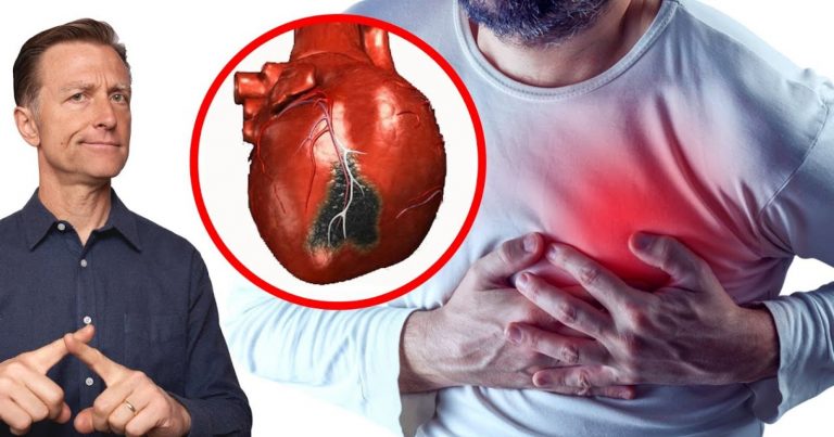 Infarto, questi 7 sintomi potrebbero comparire una settimana prima dell’attacco cardiaco: ecco quali sono Infarto, questi 7 sintomi potrebbero comparire una settimana prima dell’attacco cardiaco: ecco quali sono