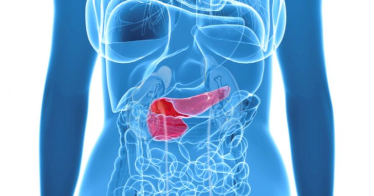 Pancreatite acuta, il dottor Mauro Montuori spiega qual è il sintomo più comune per riconoscerla Pancreatite acuta, il dottor Mauro Montuori spiega qual è il sintomo più comune per riconoscerla