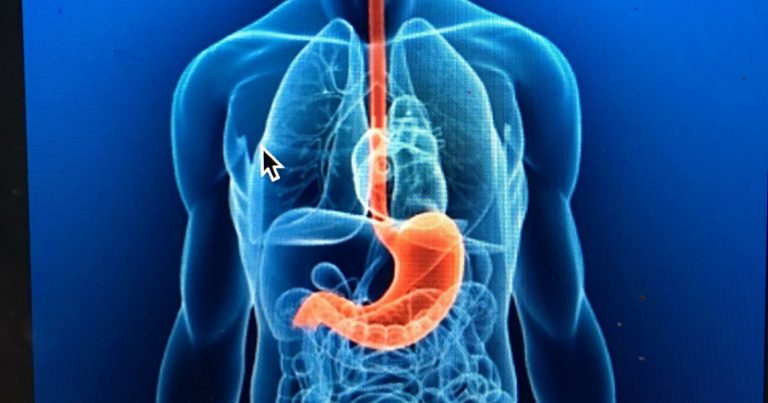 Tumore dell’esofago: attenzione a questo primo strano sintomo. Ecco quale e gli altri segnali da non sottovalutare