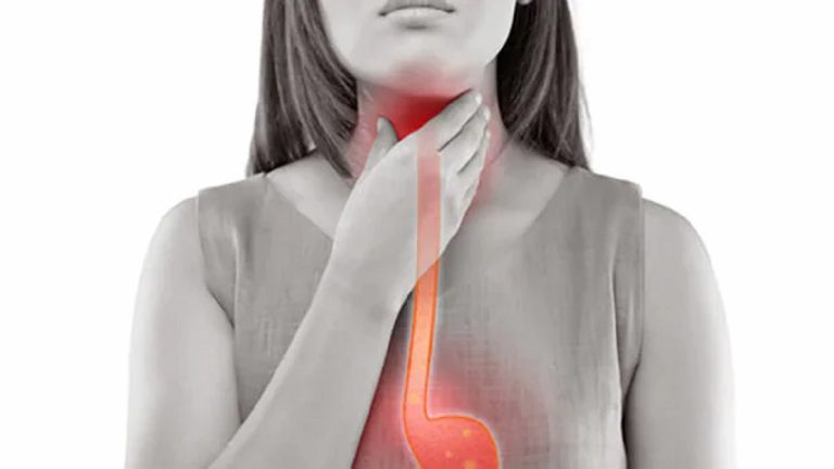 Allarme gastrite e reflusso gastroesofageo, una vera epidemia tra gli italiani: ecco cosa sta accadendo secondo gli esperti Allarme gastrite e reflusso gastroesofageo, una vera epidemia tra gli italiani: ecco cosa sta accadendo secondo gli esperti