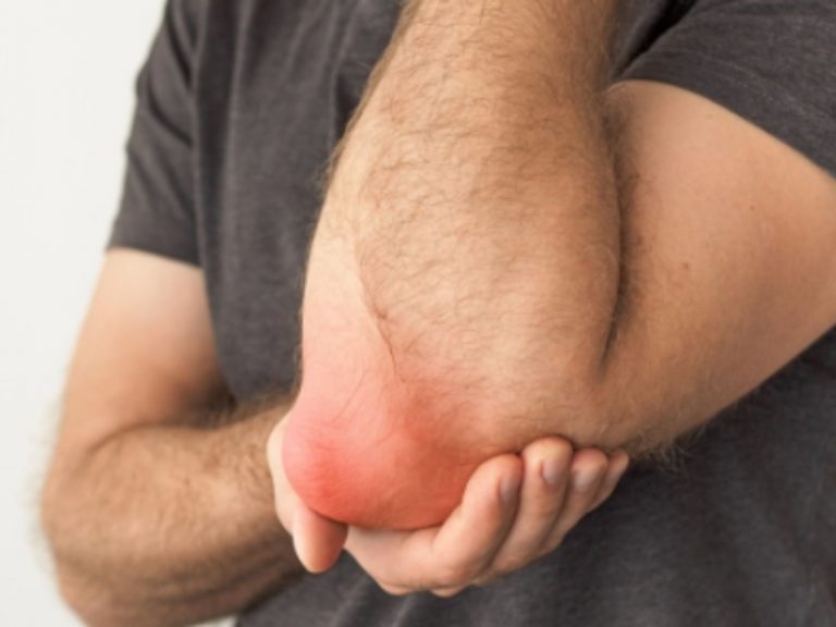 Borsite, ecco i 5 sintomi cui fare attenzione per evitare complicazioni Borsite, ecco i 5 sintomi cui fare attenzione per evitare complicazioni
