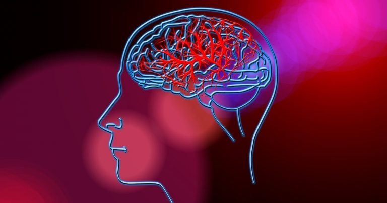 Ictus cerebrale, tra i sintomi ce n’è uno improvviso e privo di cause. Ecco di cosa si tratta Ictus cerebrale, tra i sintomi ce n’è uno improvviso e privo di cause. Ecco di cosa si tratta