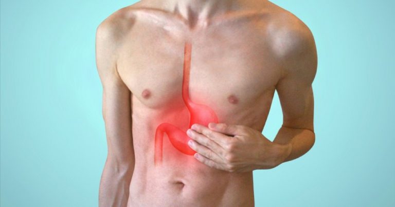 Reflusso gastroesofageo, il dottor Ugo Elmore spiega quali sono i sintomi e perché è importante non sottovalutarlo Reflusso gastroesofageo, il dottor Ugo Elmore spiega quali sono i sintomi e perché è importante non sottovalutarlo