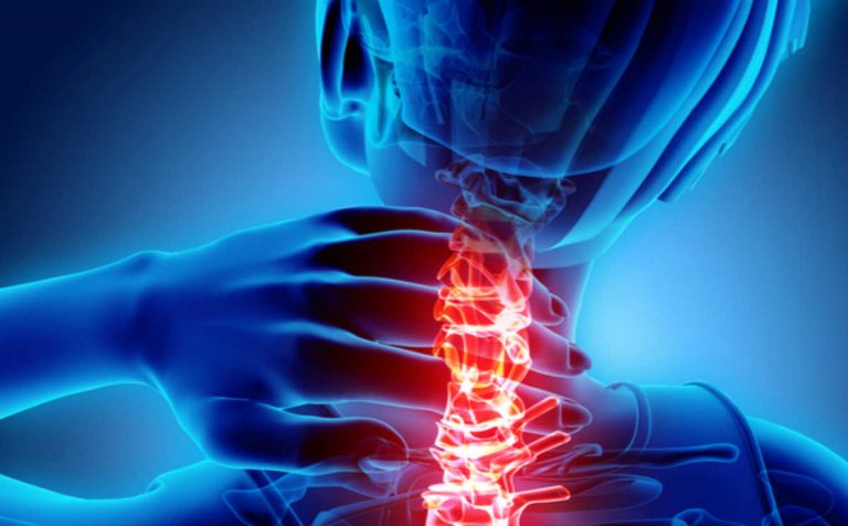 Cervicale, ecco qual è il sintomo da non ignorare. Le cause e come prevenirla Cervicale, ecco qual è il sintomo da non ignorare. Le cause e come prevenirla