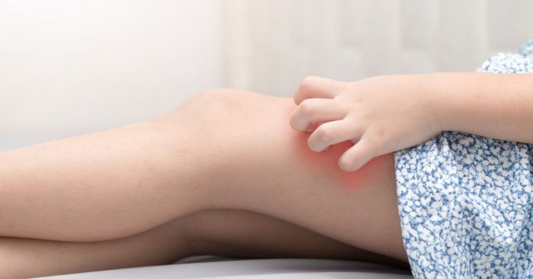 Hai prurito costante alle gambe? Ecco le patologie che potresti avere