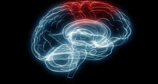 alzheimer