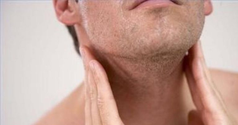 Linfoma, attenzione a questi 10 sintomi da non sottovalutare: ecco quali sono Linfoma, attenzione a questi 10 sintomi da non sottovalutare: ecco quali sono