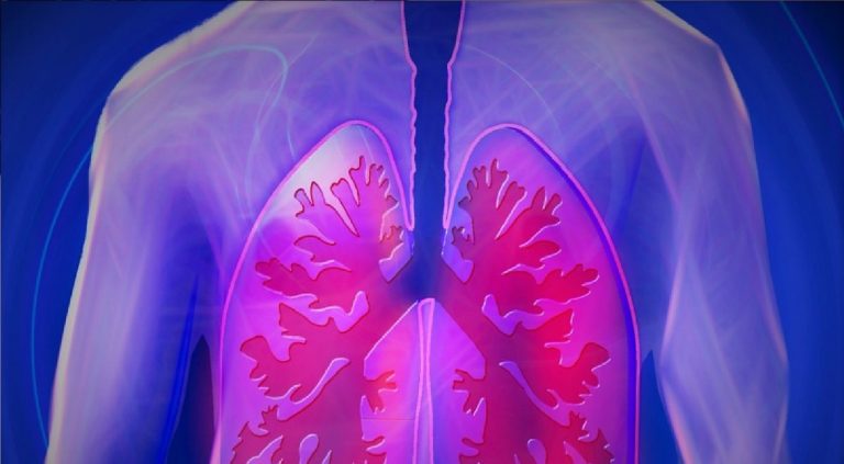 Tumore ai polmoni: i 7 sintomi da non sottovalutare