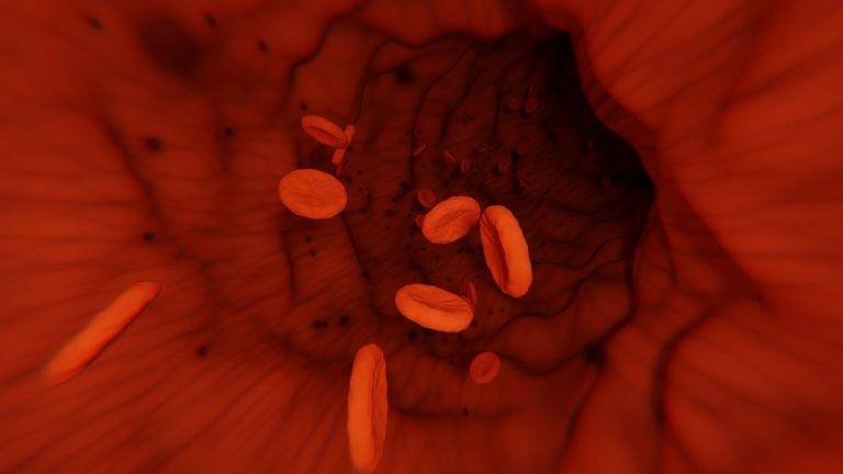 Leucemia mieloide acuta, il Dottor Matteo Della Porta svela quali sono i sintomi che si manifestano all’inizio della malattia Leucemia mieloide acuta, il Dottor Matteo Della Porta svela quali sono i sintomi che si manifestano all’inizio della malattia