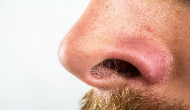 Rinite allergica, come riconoscerla dai sintomi e quando andare dall’allergologo