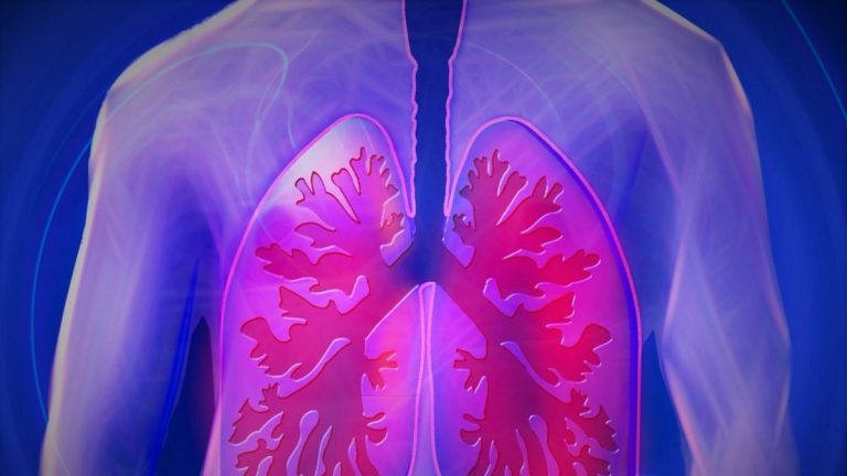 Tumore ai polmoni, la malattia di Andrea Purgatori: ecco i sintomi da non ignorare