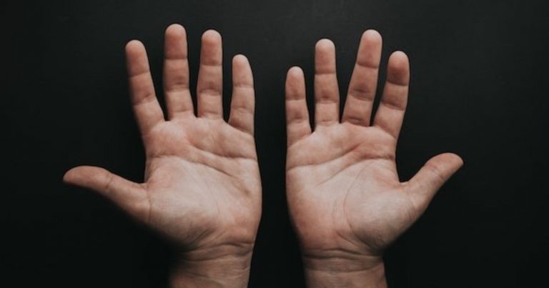 Formicolio alle dita delle mani, ecco quando ci si deve rivolgere al medico. Le cause e le malattie associate