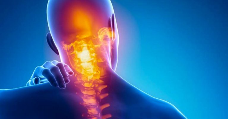 Dolore cervicale che non passa, gli errori da non commettere e le possibili soluzioni