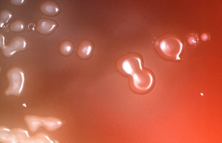 Streptococco, casi in aumento in Italia: ci sono morti e persone in terapia intensiva. Ecco quali sono i rischi Streptococco, casi in aumento in Italia: ci sono morti e persone in terapia intensiva. Ecco quali sono i rischi