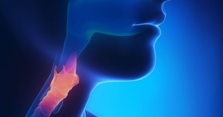 Tumore alla gola, i sintomi e come riconoscere la malattia Tumore alla gola, i sintomi e come riconoscere la malattia