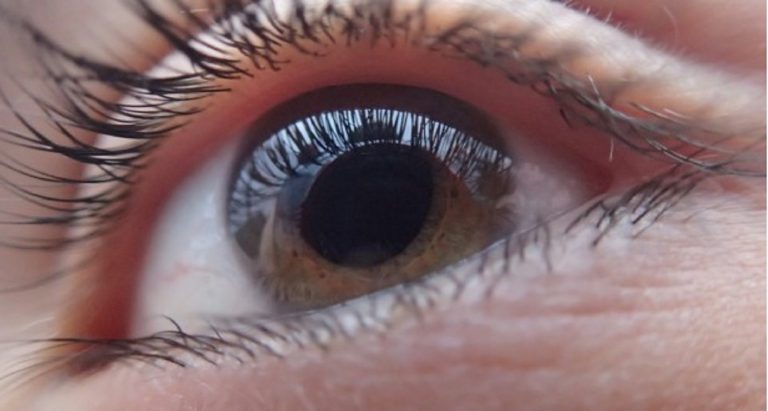 Retinite pigmentosa, la malattia di cui soffre Annalisa Minetti: ecco quali sono i sintomi e le cause Retinite pigmentosa, la malattia di cui soffre Annalisa Minetti: ecco quali sono i sintomi e le cause