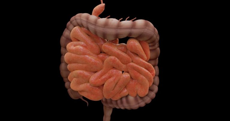 Intestino infiammato, il Dottor Franco Berrino svela: ecco quali sono gli alimenti da evitare