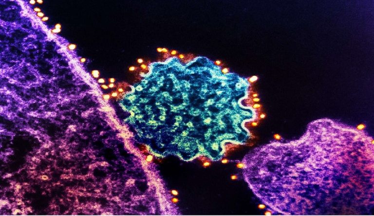 Virus Nipah, registrati alcuni casi positivi: ecco quali sono i sintomi Virus Nipah, registrati alcuni casi positivi: ecco quali sono i sintomi