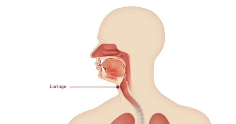 Tumore della laringe: attenzione a questi strani sintomi. Ecco quali sono