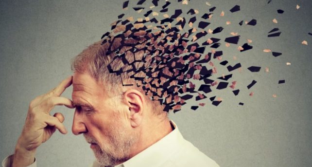 morbo di alzheimer