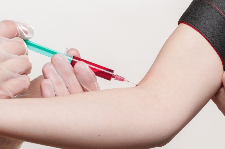 Prelievi di sangue senza aghi, dagli Usa la novità per fare le analisi senza dolore Prelievi di sangue senza aghi, dagli Usa la novità per fare le analisi senza dolore