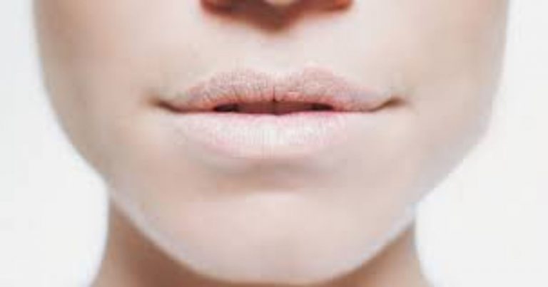 Secchezza delle fauci o bocca secca: attenzione a questo sintomo che può nascondere malattie da non sottovalutare. I rimedi. Secchezza delle fauci o bocca secca: attenzione a questo sintomo che può nascondere malattie da non sottovalutare. I rimedi.