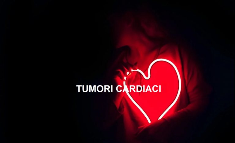 Tumore cardiaco, il Dottor Carlo Cipolla spiega: “Se non scoperto presto può essere letale…”. Ecco quali sono i sintomi