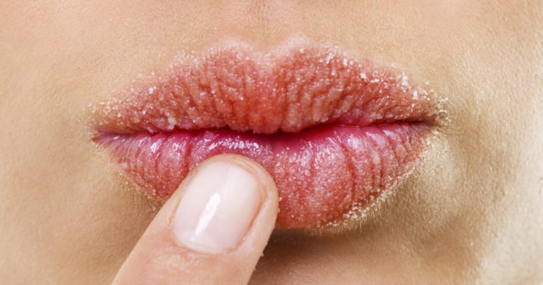 Bocca secca, un sintomo che può indicare queste malattie: ecco quando bisogna rivolgersi al medico Bocca secca, un sintomo che può indicare queste malattie: ecco quando bisogna rivolgersi al medico