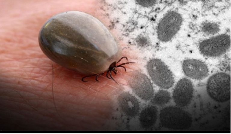 Virus Wetland trasmesso dalle zecche: cosa sappiamo e quali sono i sintomi Virus Wetland trasmesso dalle zecche: cosa sappiamo e quali sono i sintomi
