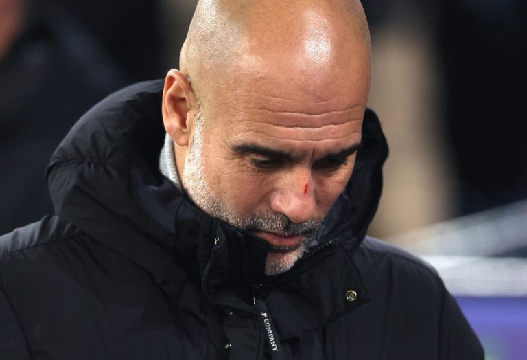 Guardiola ferito con dei graffi sul volto: ecco cos’è successo al tecnico del Manchester City