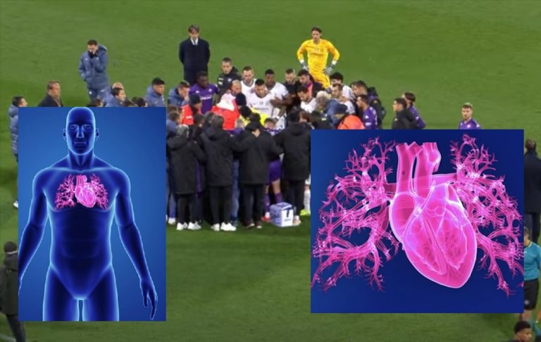 Tachicardia ventricolare tipo torsione di punta, i sintomi, come si diagnostica e come si cura la patologia di Edoardo Bove Tachicardia ventricolare tipo torsione di punta, i sintomi, come si diagnostica e come si cura la patologia di Edoardo Bove