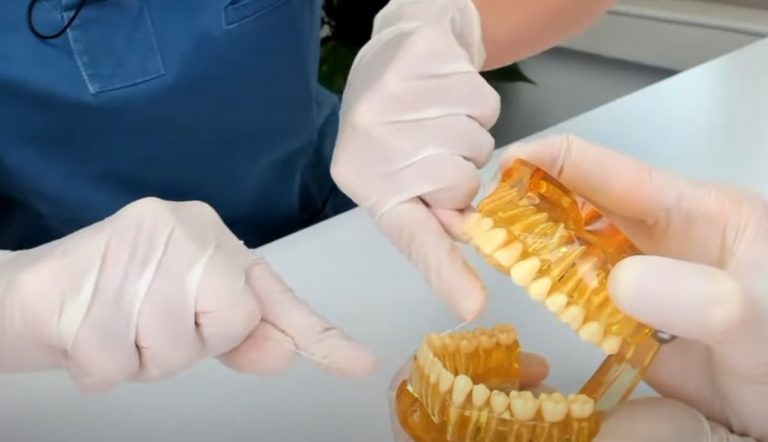 I vaccini del futuro verranno somministrati con filo interdentale: ecco cosa si è scoperto