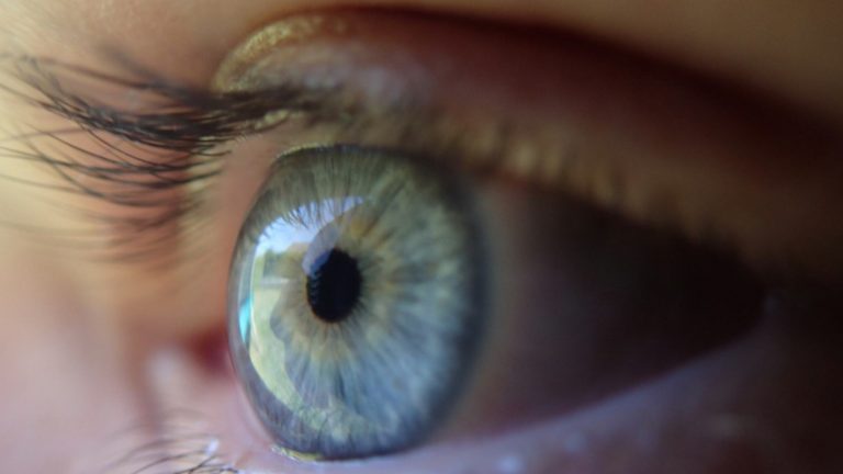 Distacco della retina, il dottor Gaspare Monaco spiega quali sono i sintomi iniziali da non sottovalutare Distacco della retina, il dottor Gaspare Monaco spiega quali sono i sintomi iniziali da non sottovalutare